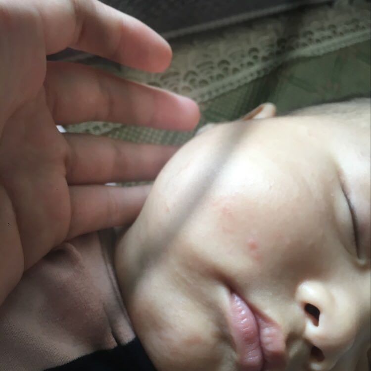 各位宝妈  帮我看下我宝宝这个长的是什么
