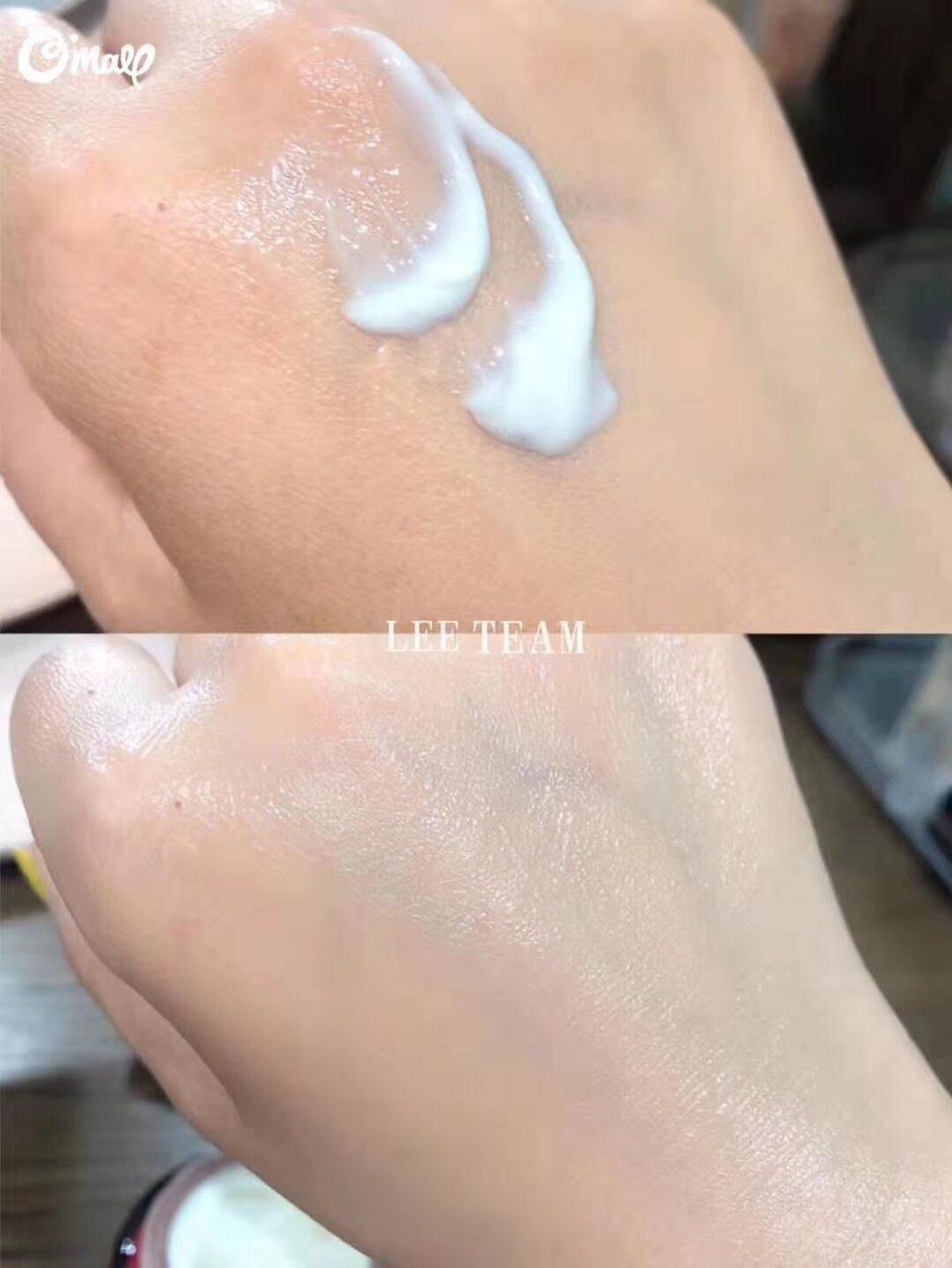 SK-II