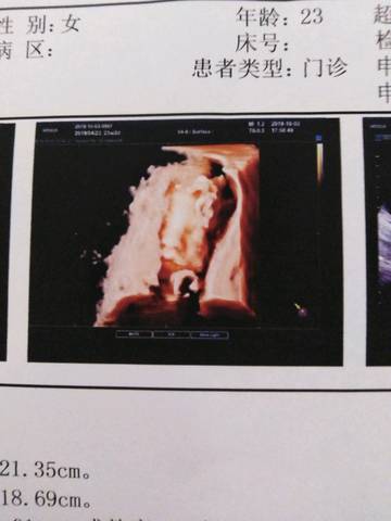 journal_insert_pic_1325737428