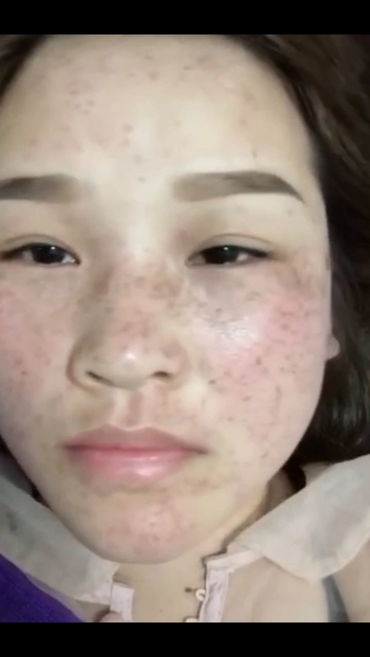 告别五年麻子脸，终于下班了