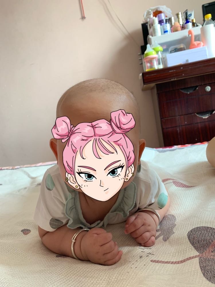 五个月宝宝没有头发