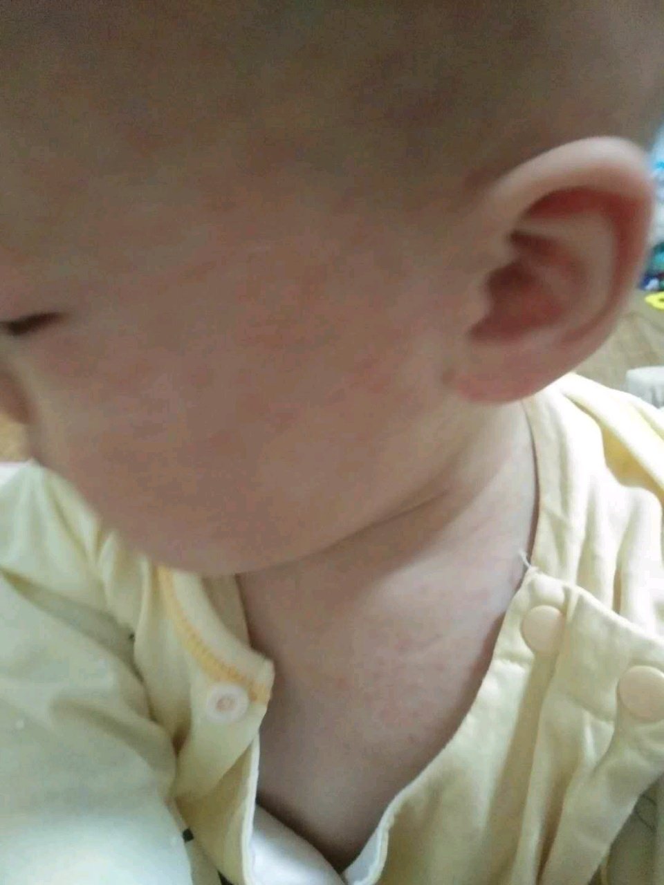 幼儿急诊宝妈聊聊