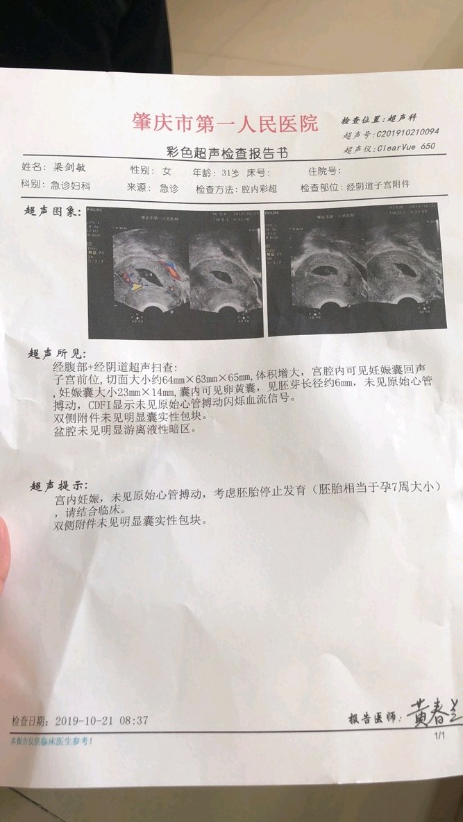 经验者麻烦帮帮忙，这个是我小姑B超单，懂的人给点建议，谢谢了