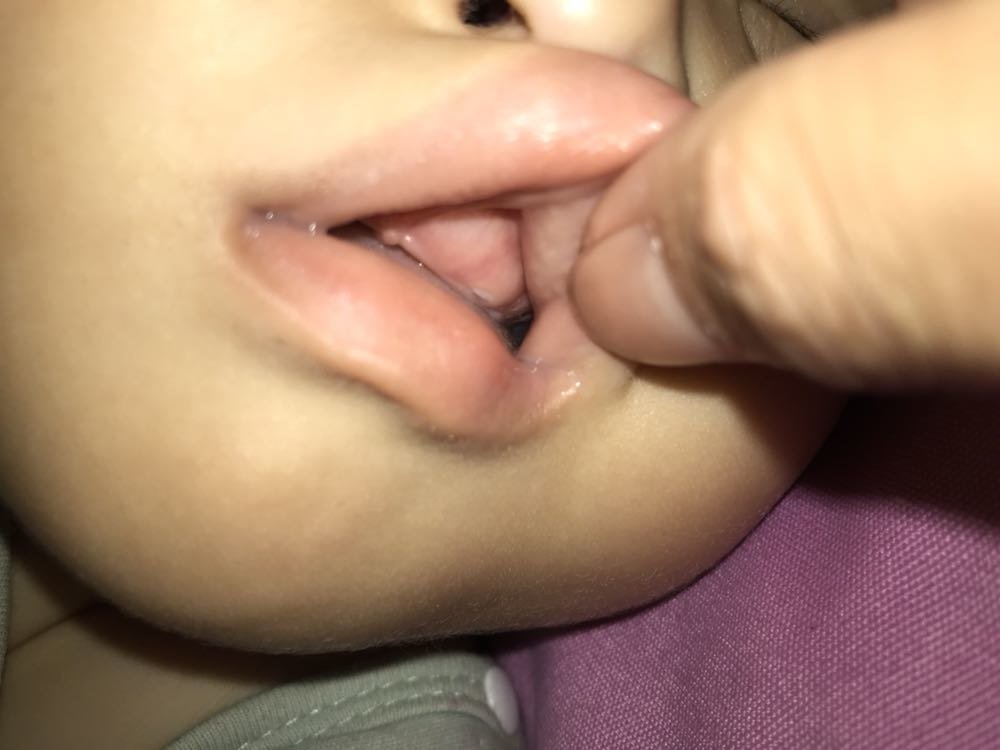 长牙