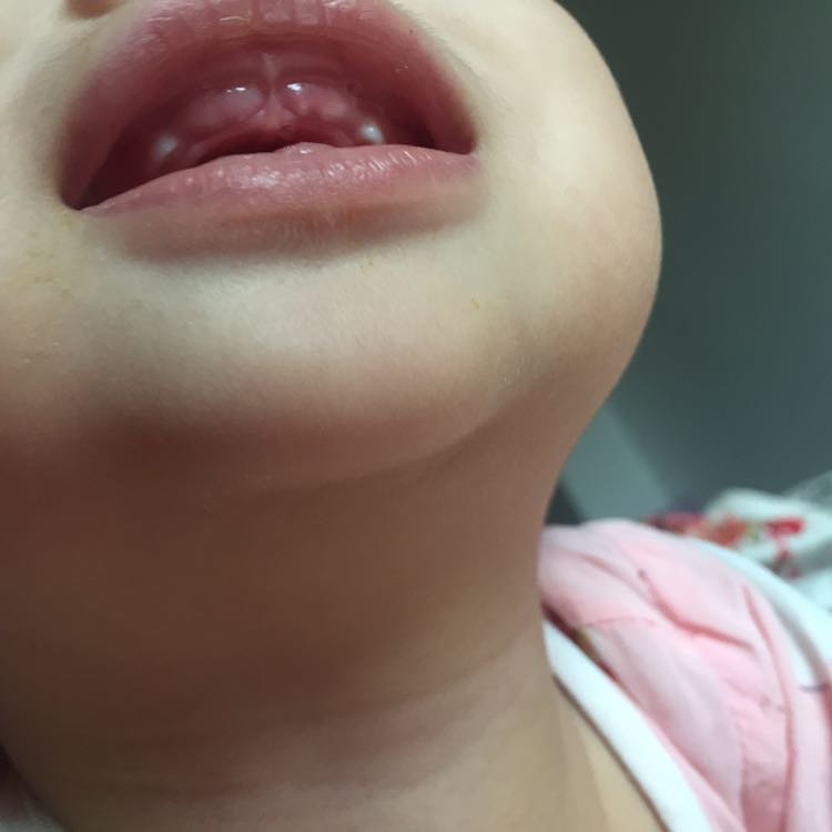 麻烦帮我看下这是就长门牙吗？