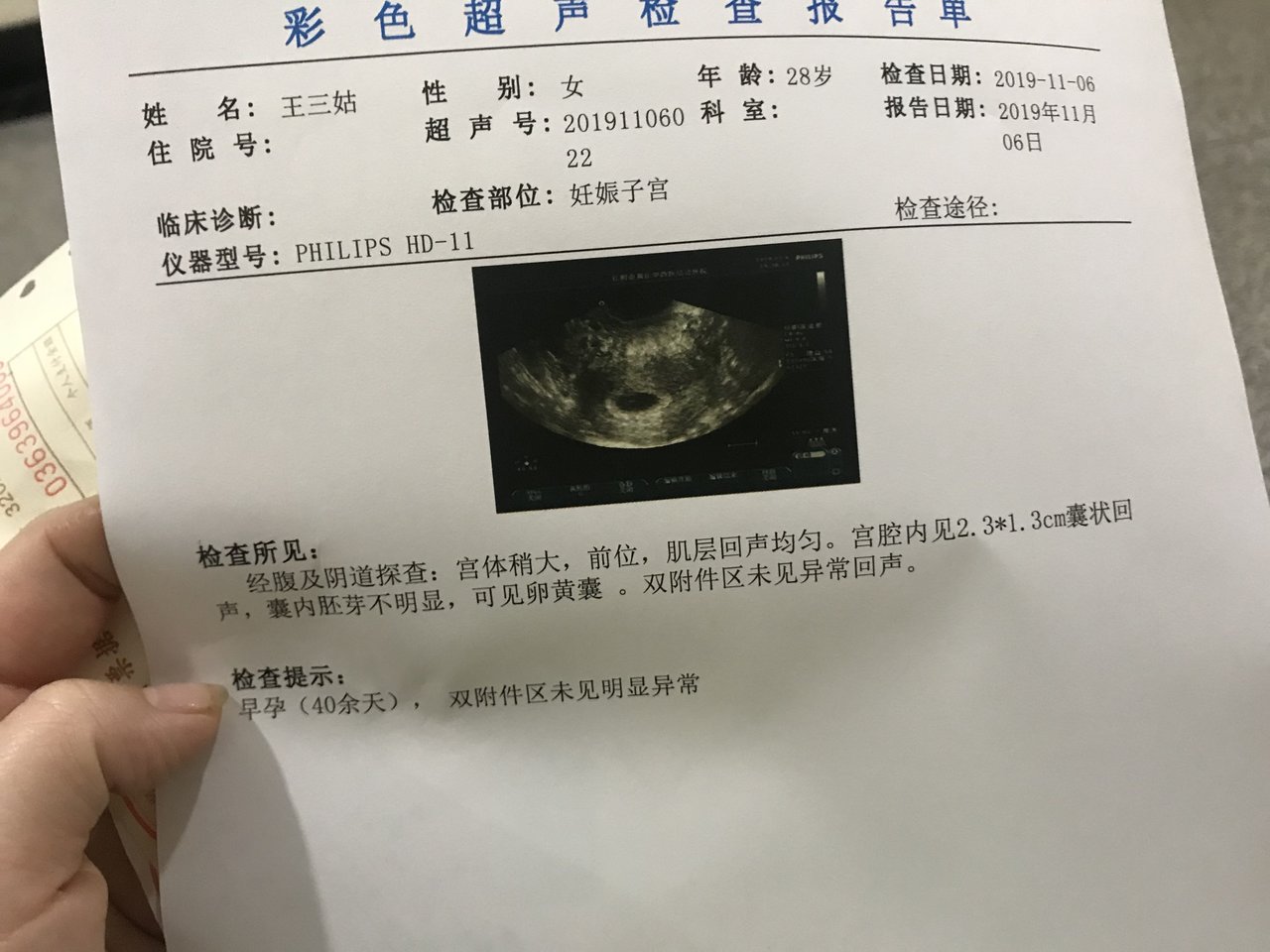 是不是惊喜