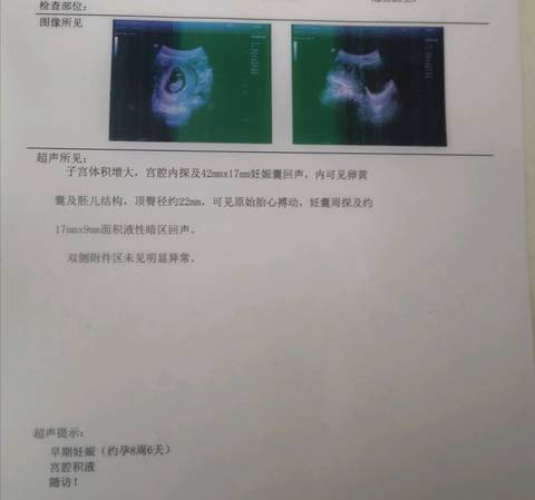 journal_insert_pic_1347799160