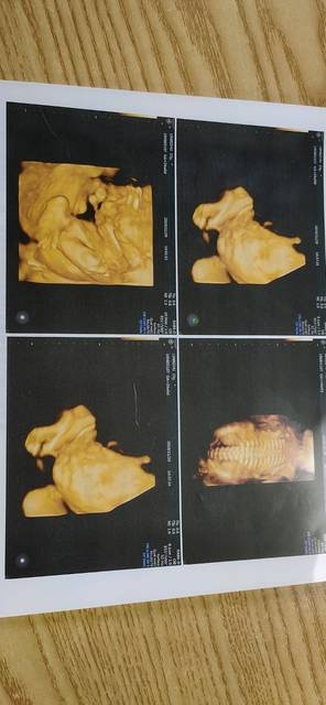 做了四维不知道是男孩女孩