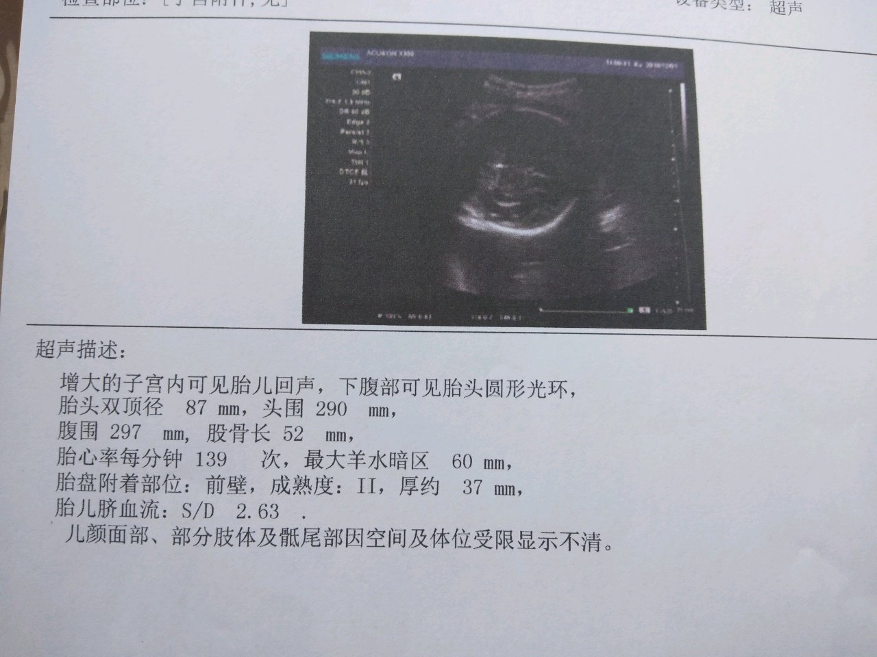 宝妈们31周宝宝双顶径和股骨长是多少啊