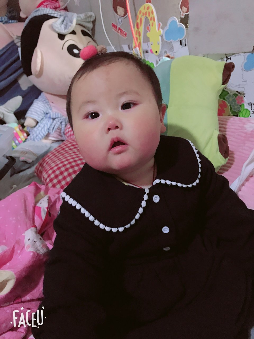 宝宝脸上有鲜红斑痣的宝妈吗！