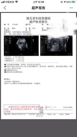 journal_insert_pic_1463310319