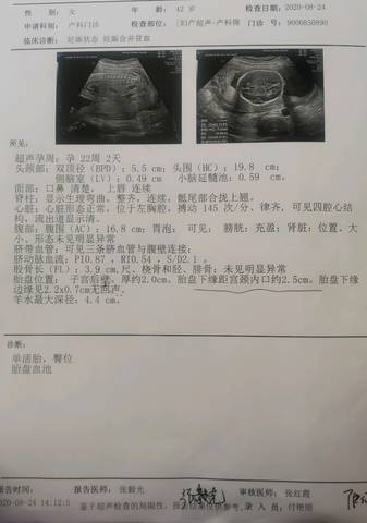 journal_insert_pic_1472594534
