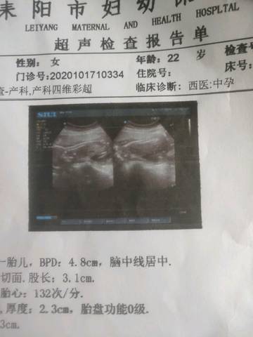 journal_insert_pic_1494255206