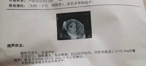 journal_insert_pic_1502484174