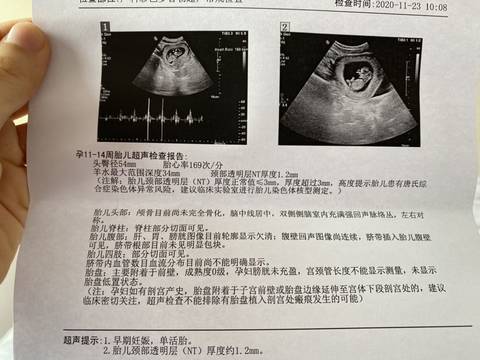 journal_insert_pic_1508819635