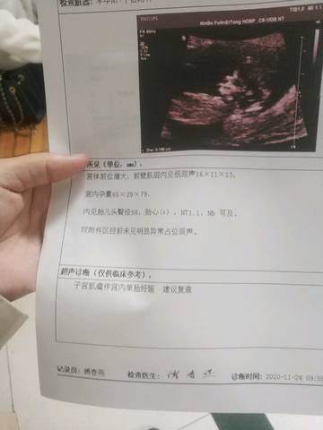 journal_insert_pic_1509208312
