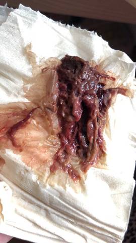 不知道要不要紧啊