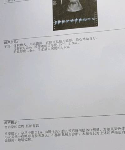 journal_insert_pic_1512110109