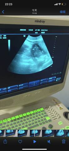 怀孕18周胎儿图片欣赏图片