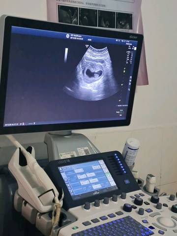 孕8周胎儿真实图图片