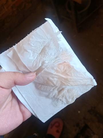 38 3天,小便纸巾擦拭有粉红色的液体,阵痛感没那么强烈,而且不是规律