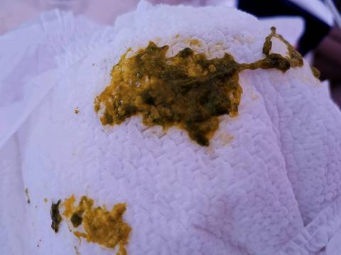 纯母乳喂养,一天拉三四次绿粑粑,每次尿不湿上都会有一点,是吃多了