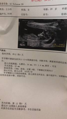 journal_insert_pic_1533856985