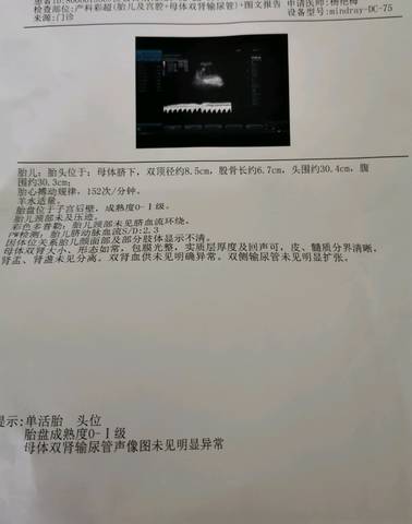 journal_insert_pic_1543692381