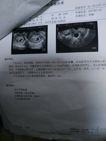 journal_insert_pic_1549112541