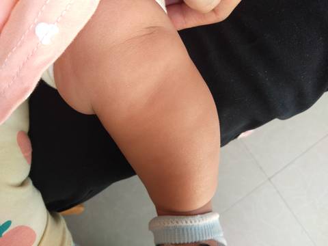 15个月宝宝罗圈腿图片图片