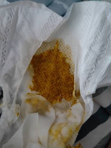 有图勿进,母乳喂养,宝宝拉的屎正常吗.天天都是这样