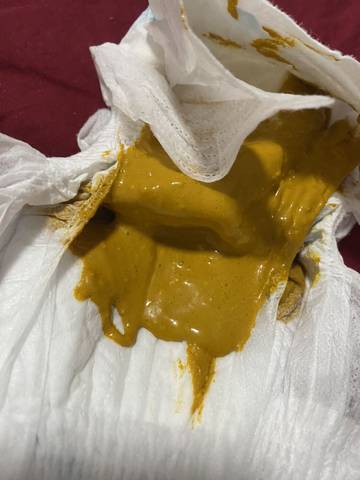 宝宝大便正常吗?