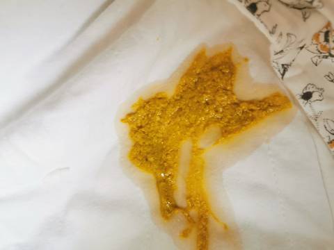 宝宝的这个粑粑正常吗?