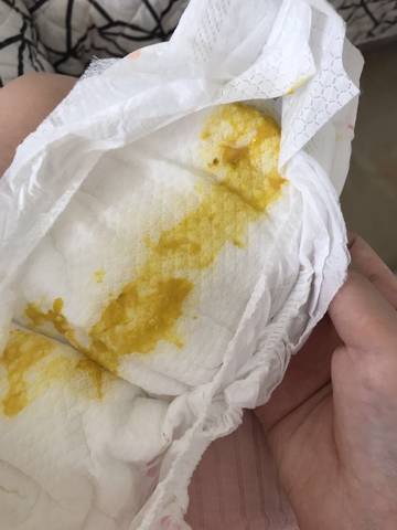 请问这是果冻样便便吗 是不是有问题 (三个月宝宝,纯母乳,一天拉四次)