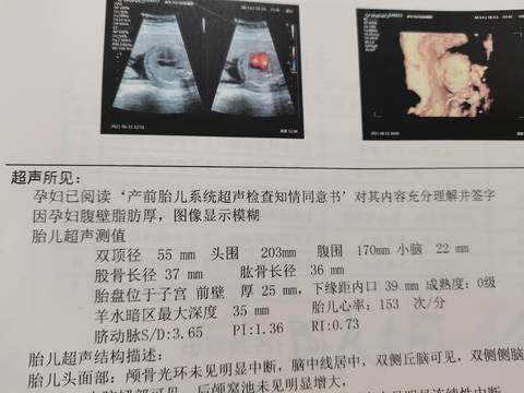 journal_insert_pic_1589584733