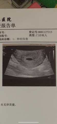 怀孕三十几天孕囊图片图片