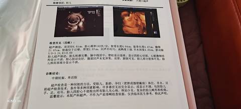 journal_insert_pic_1610909938