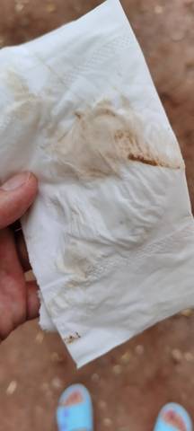 怀孕5周 2 每天有这样褐色的分泌物 正常吗?需要在抽个血吗?