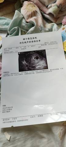 没怀孕的阴超单子图片图片