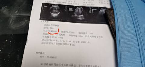 journal_insert_pic_1617222519