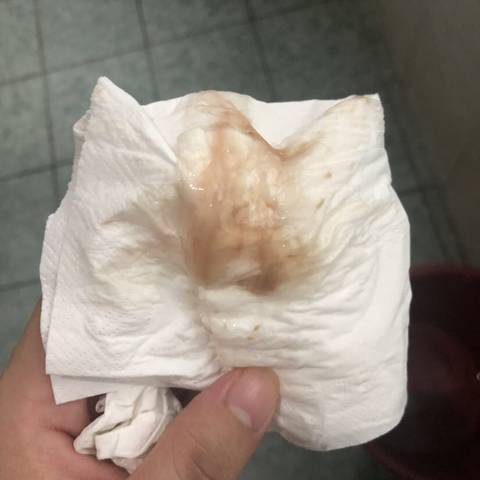 孕晚期40周2,今天流了褐色分泌物,这算不算是见红?这样可以马上生吗?
