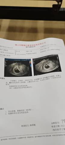 怀孕4周孕囊大小图片图片