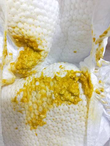 一个月的宝宝拉的便便正常吗?