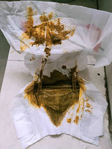 这样的便便是不是受凉了?