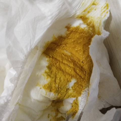 27天的小宝宝大便这样子是正常的吗?
