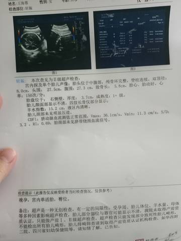 journal_insert_pic_1629957189