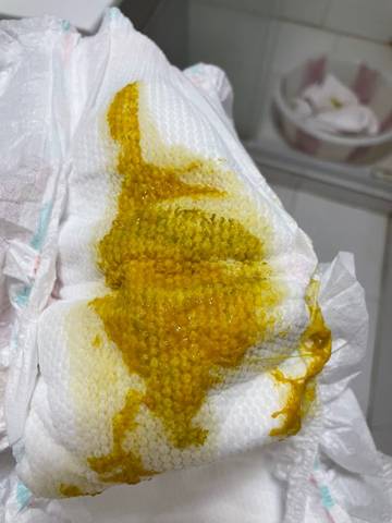 之前吃了布拉氏酵母菌大便次数9次,只吃蒙托石散拉4次.