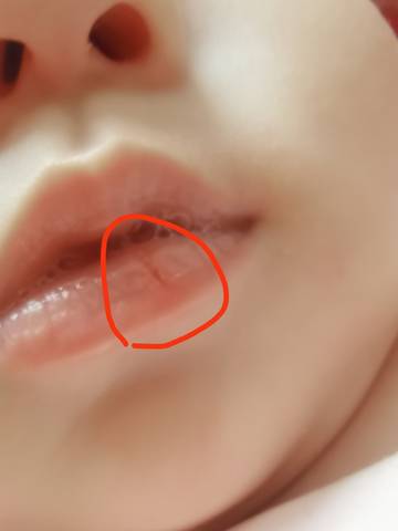 有几个问题 宝宝三个月 昨天发现嘴唇干裂 裂纹发红,这是上火吗?