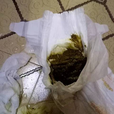 宝宝已经二个多月了,拉了一个多星期绿色的便便,这是为什么?