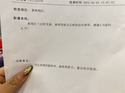 journal_insert_pic_1709630464